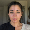DERMIRA™ Skin Mask