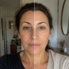 DERMIRA™ Skin Mask